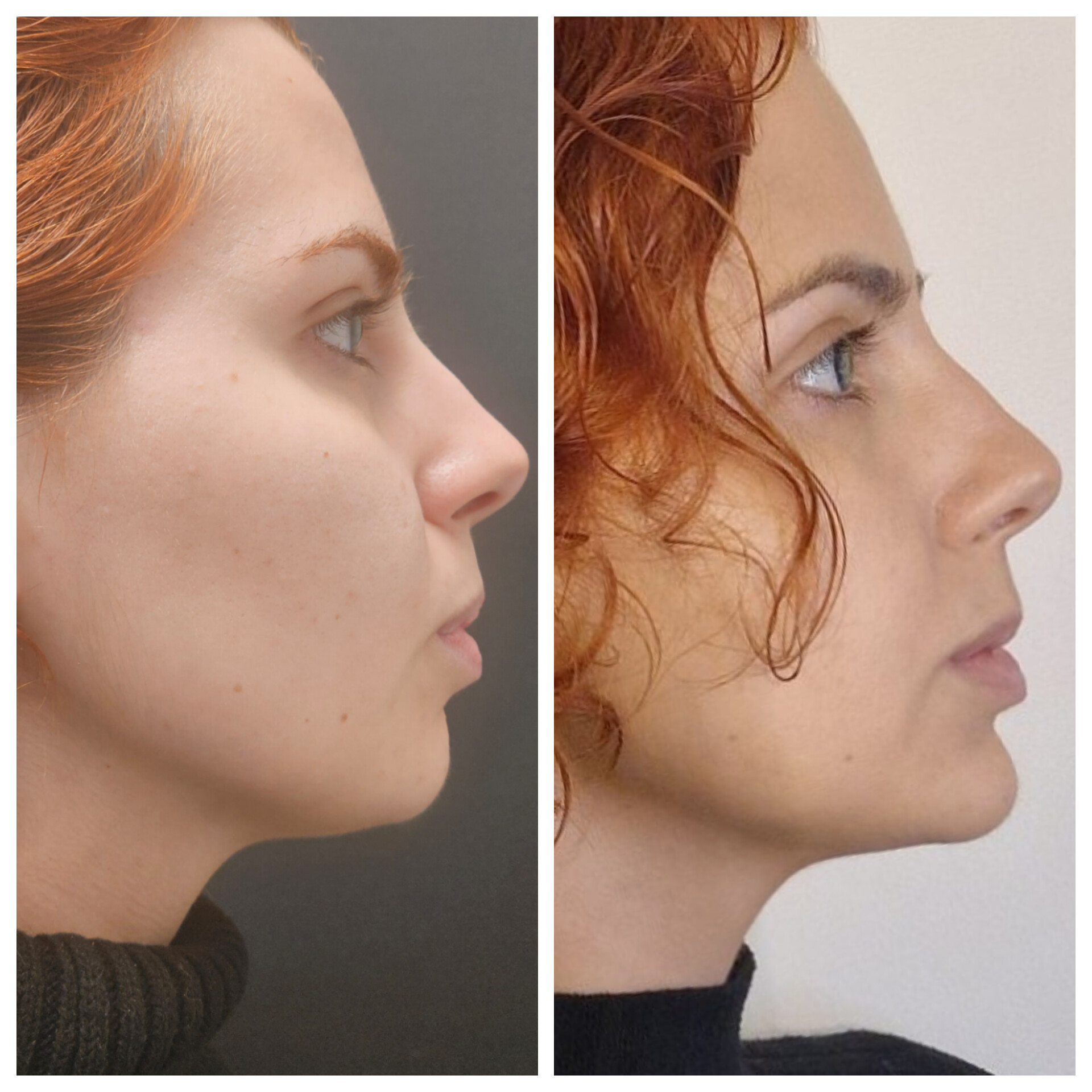 Д-р Теодор Кожухаров — 3