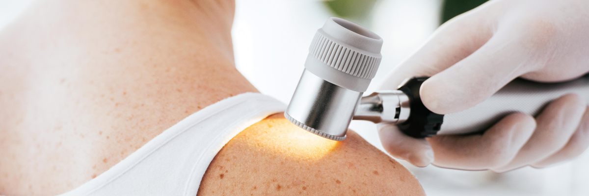 Skin tumors treated in our dermatology practice