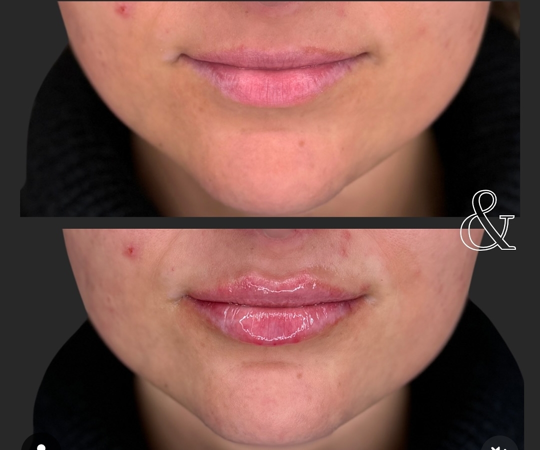 Д-р Айлин Кафелова — 5