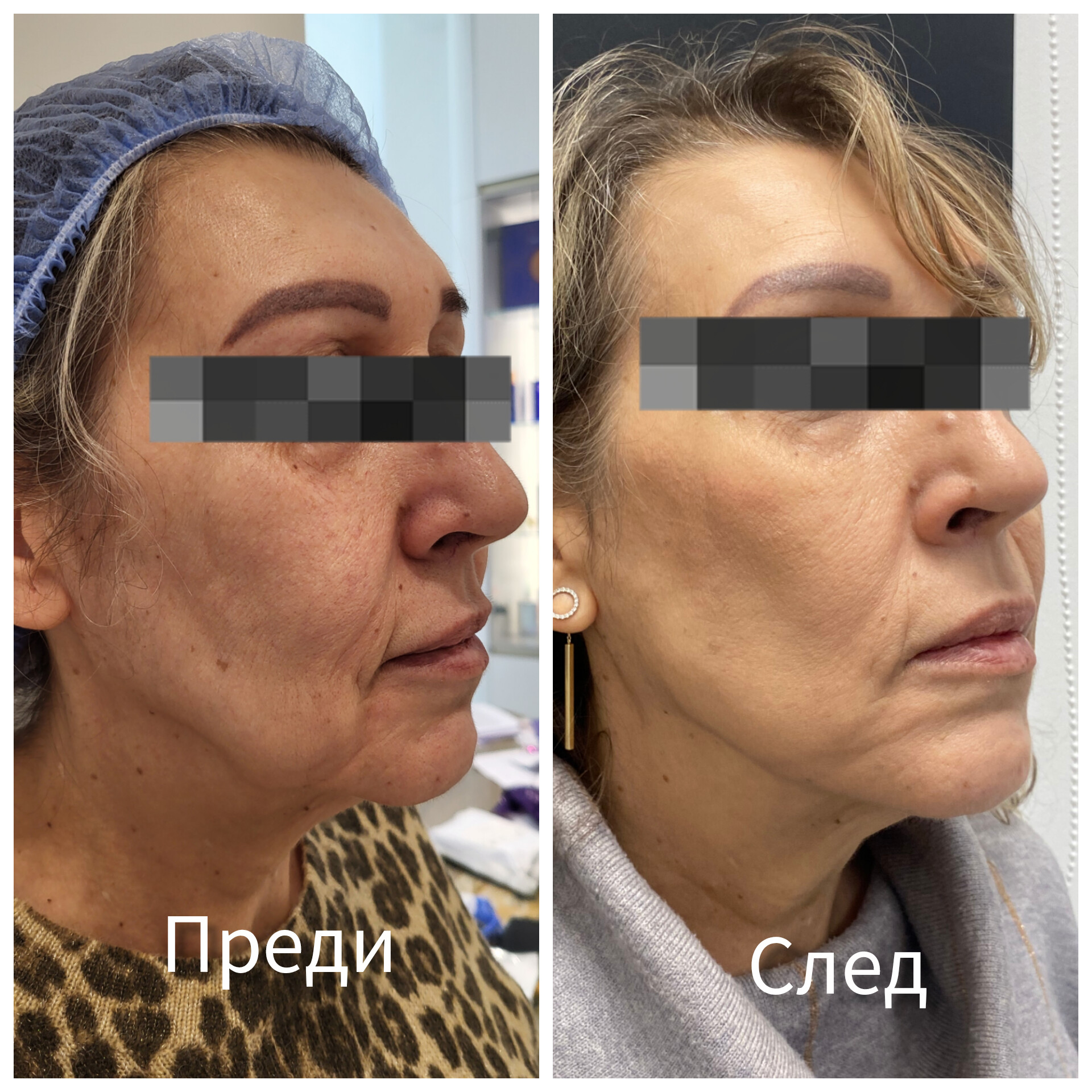 Д-р Лора Терзиева — 15