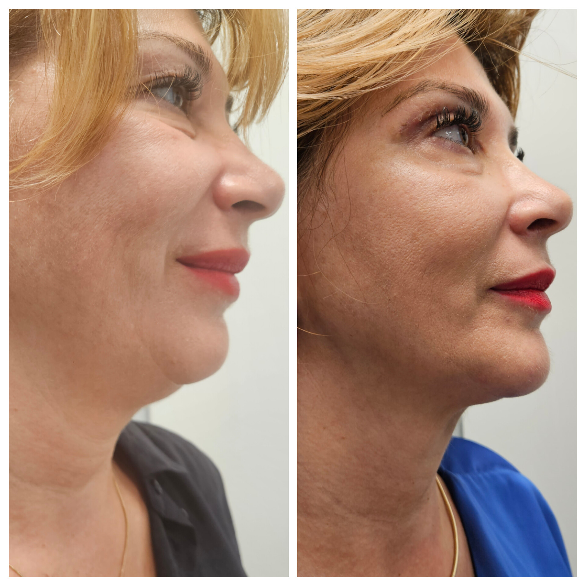 Доц. д-р Дончо Етугов — 14