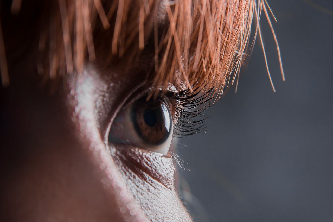 Under-eye bags removal surgery