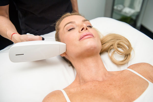 Venus Viva skin remodeling treatment result