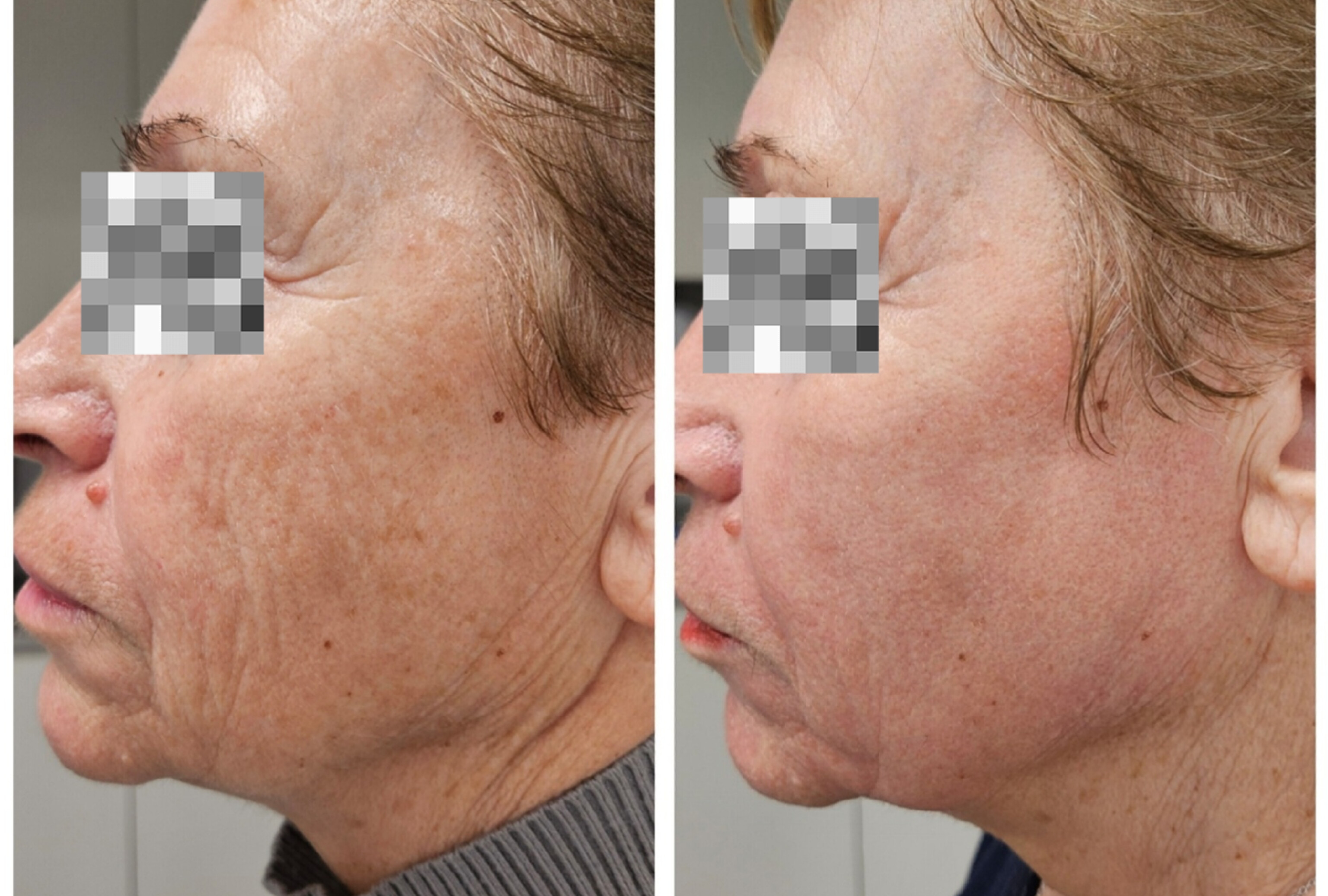 Д-р Лора Терзиева — 8