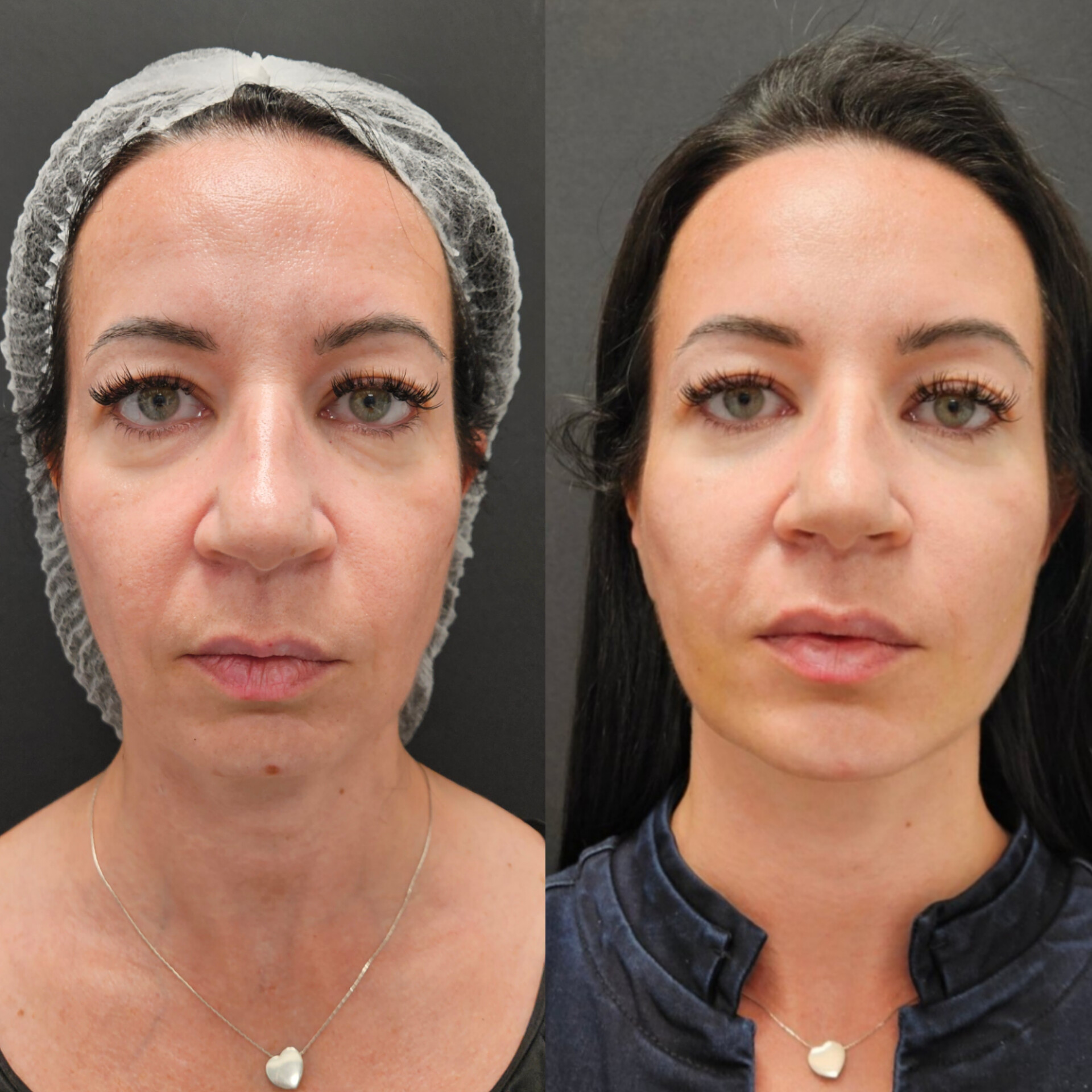 Доц. д-р Дончо Етугов — 2