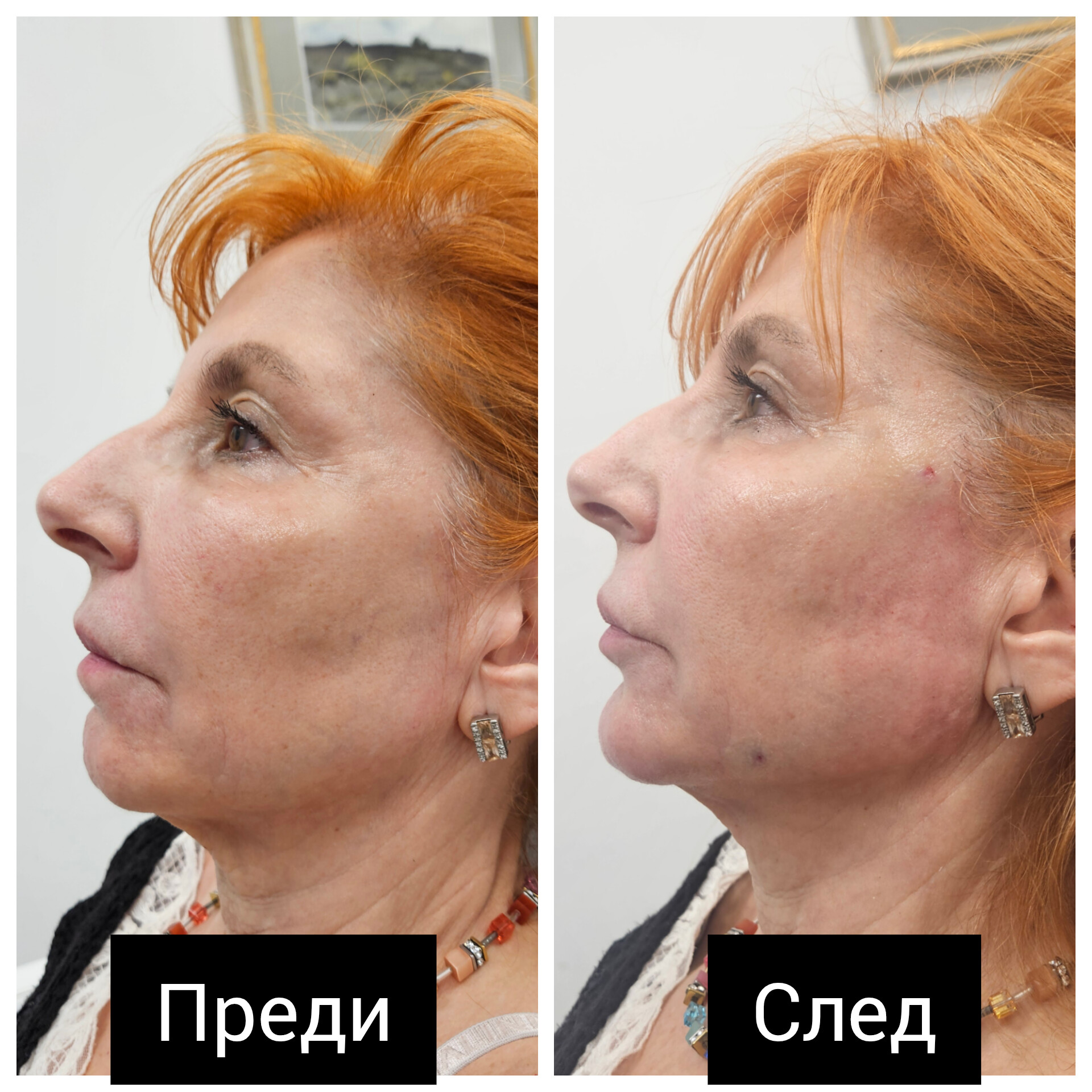 Д-р Лора Терзиева — 9