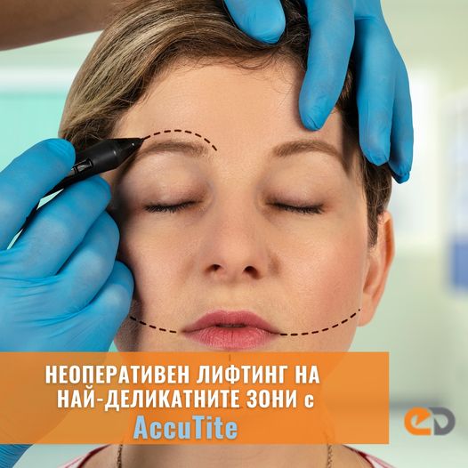 AccuTite non-surgical lifting treatment for delicate facial areas
