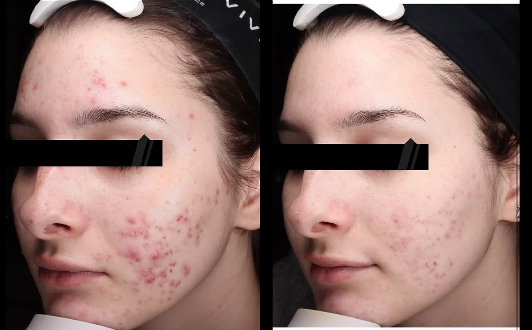 Д-р Айлин Кафелова — 4