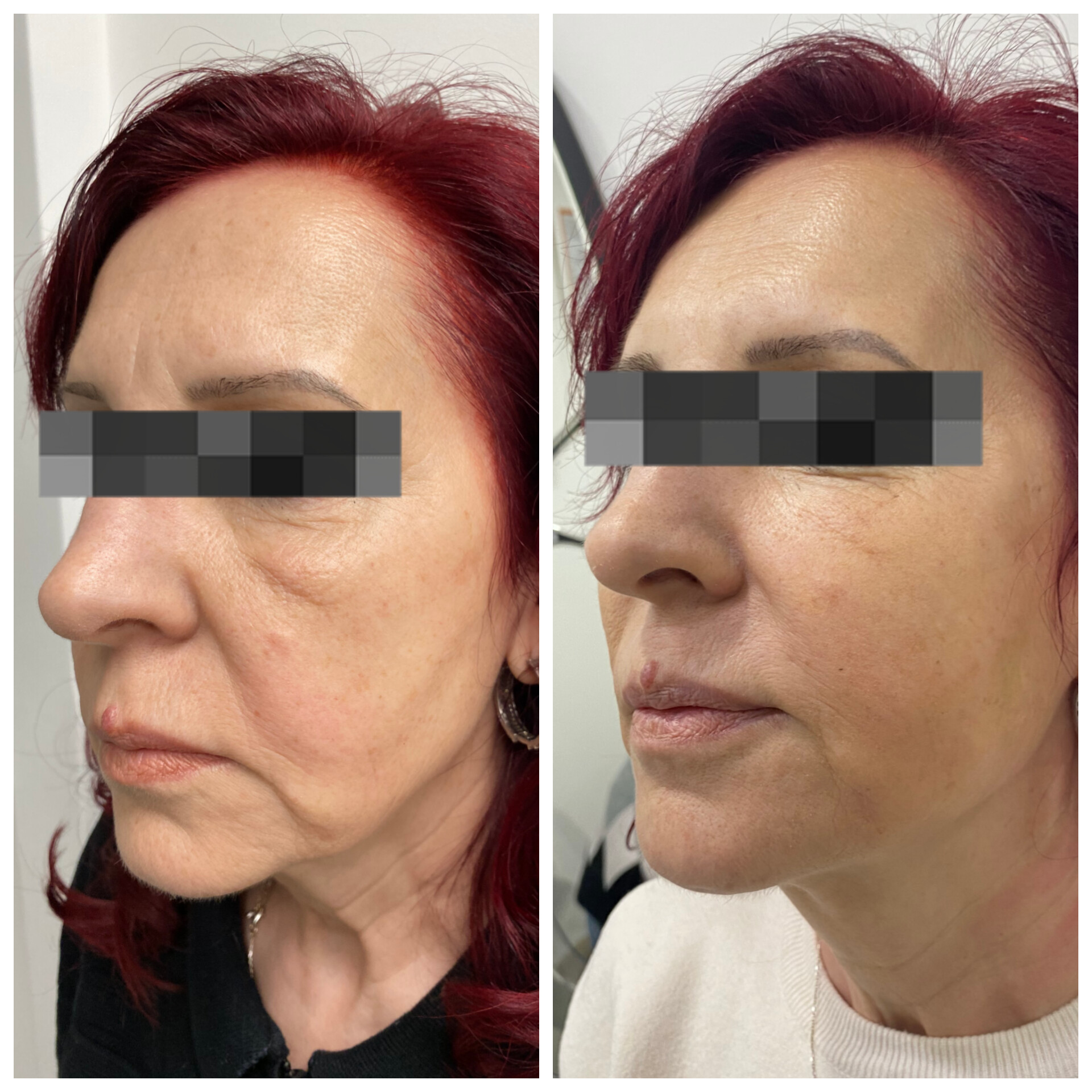 Д-р Айлин Кафелова — 3