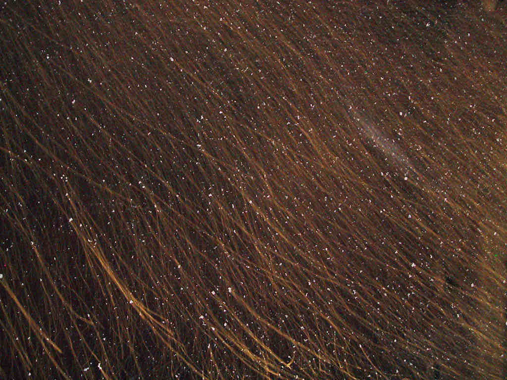 Dandruff treatment for the scalp