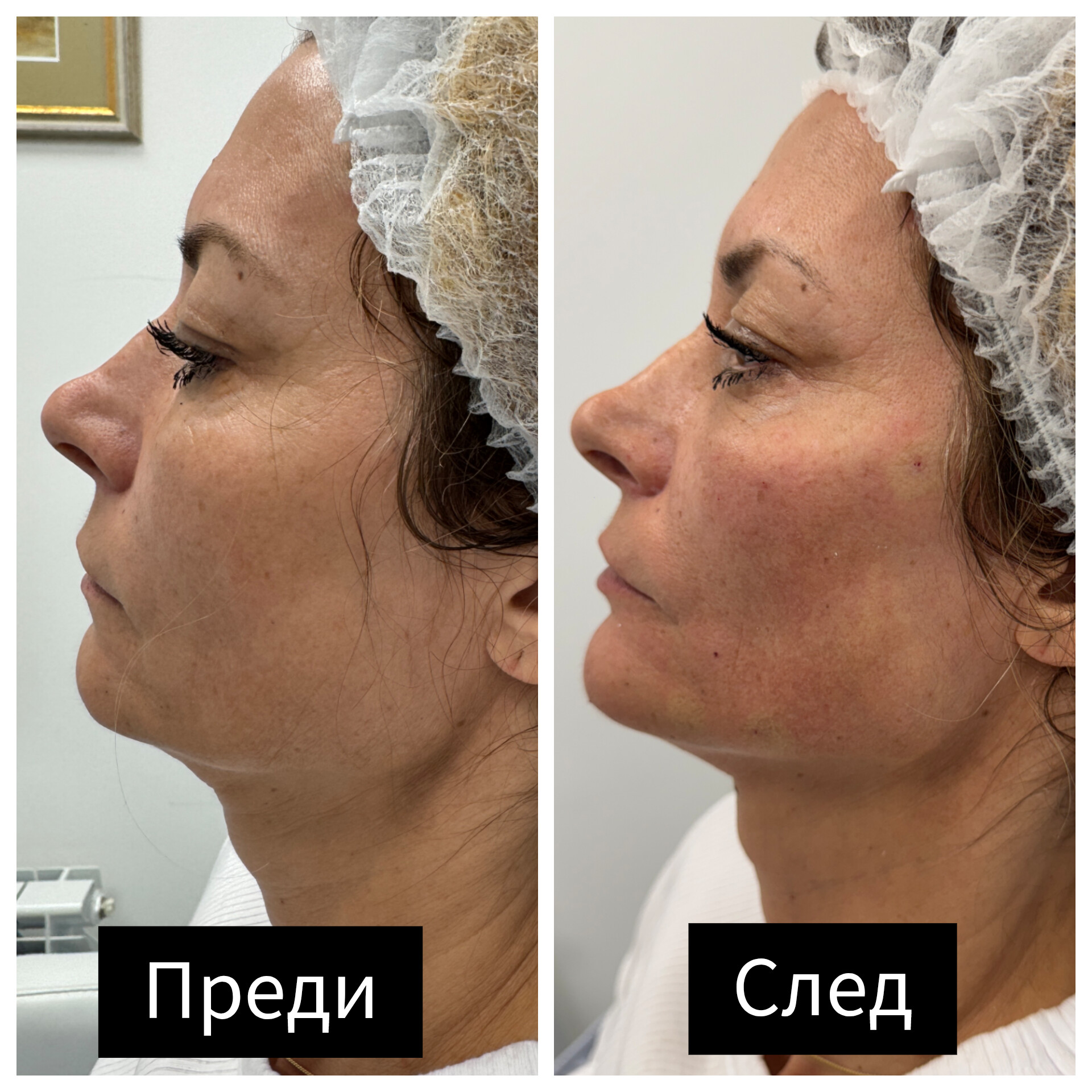 Д-р Теодор Кожухаров — 4