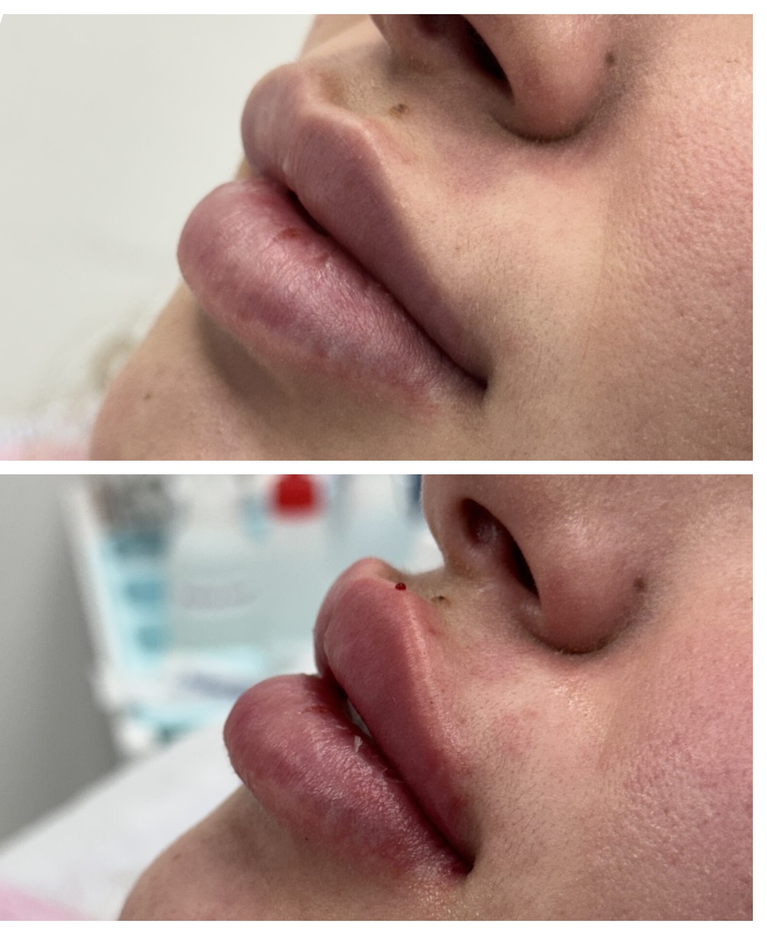 Д-р Теодор Кожухаров — 2