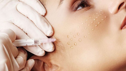 Какво е мезотерапия?