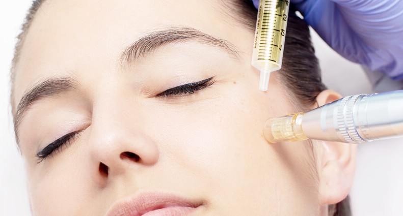 Мезотерапия за лице и коса – колко струва