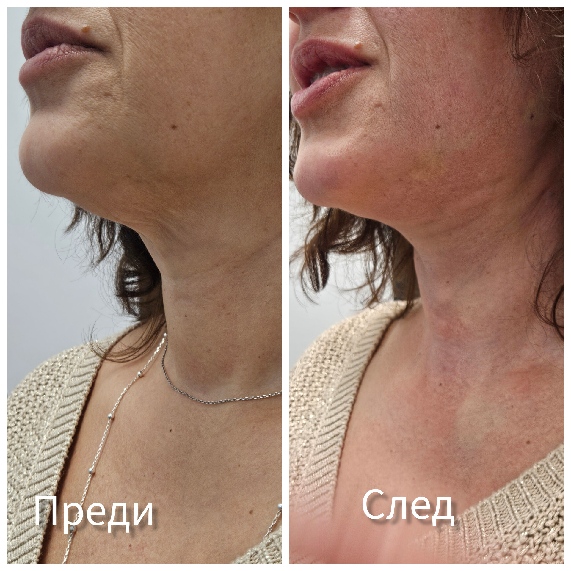 Доц. д-р Дончо Етугов — 22