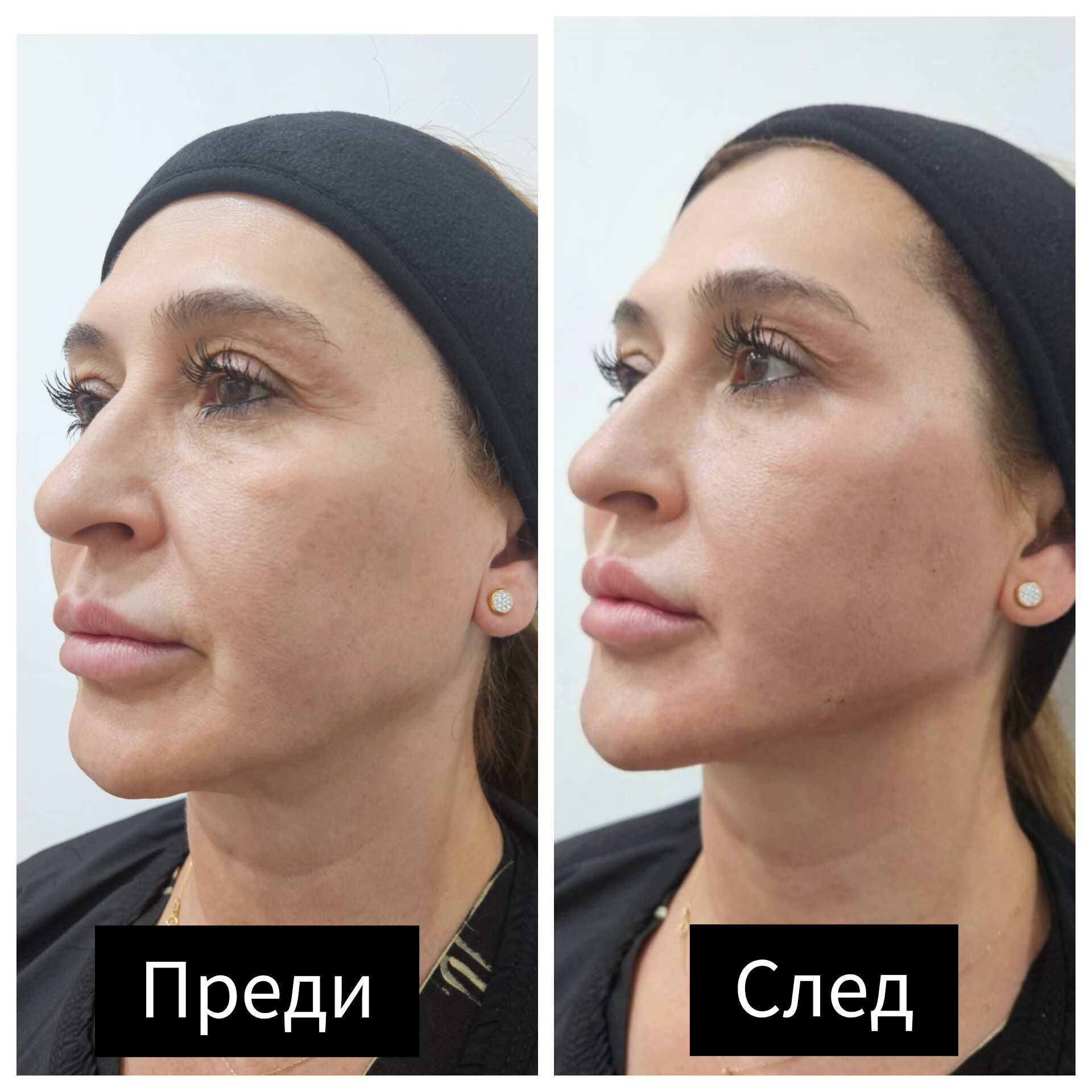 Доц. д-р Дончо Етугов — 5