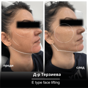 Кога мога да си запиша час за E-Type?