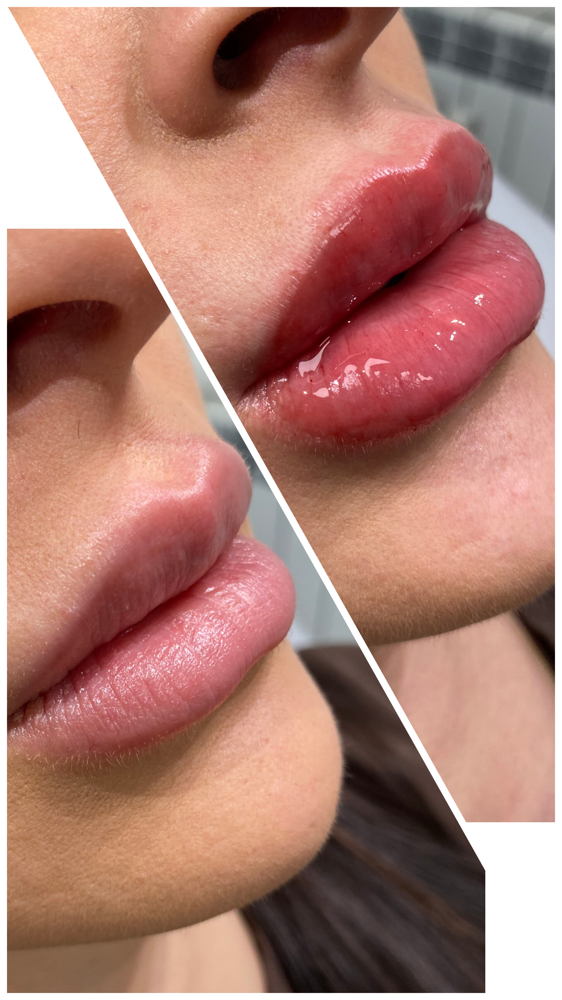 Д-р Айлин Кафелова — 2