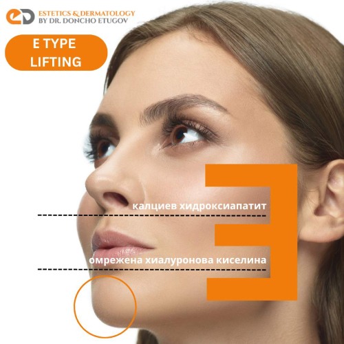 Какво представлява E-type лифтинг?